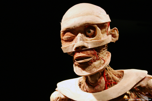 Plastinated Bodies