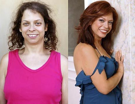 Extreme Makeovers and Plastic Surgeries