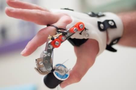 9 Amazing DIY Prosthetic Limbs