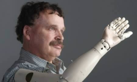 9 Amazing DIY Prosthetic Limbs