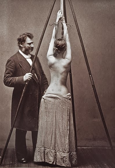 Interesting and Creepy Medical pictures from the past