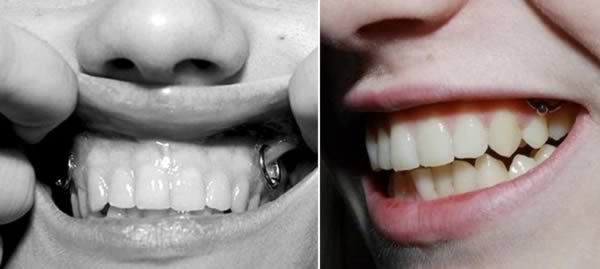 10 Most Extreme Oral Piercings And Body Mods