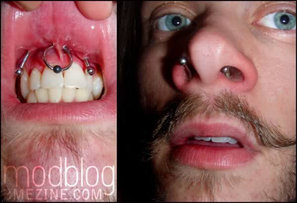 10 Most Extreme Oral Piercings And Body Mods