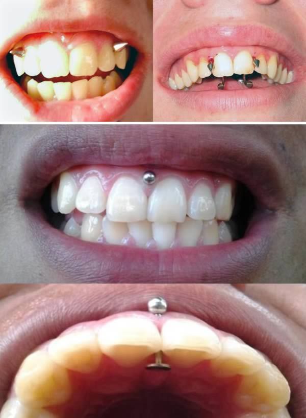 10 Most Extreme Oral Piercings And Body Mods