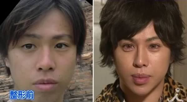 8 More of the Craziest Plastic Surgeries To Look Like Someone Else