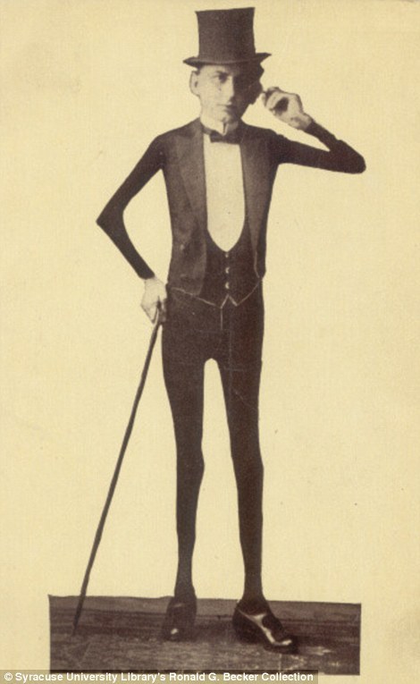 Carnival Sideshow Freaks - 19th Century