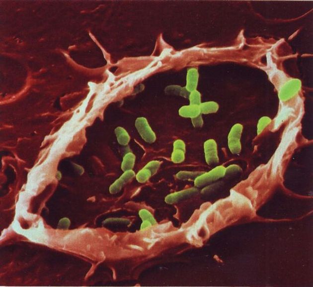 The Battle Within - Scanning Electron Microscope images