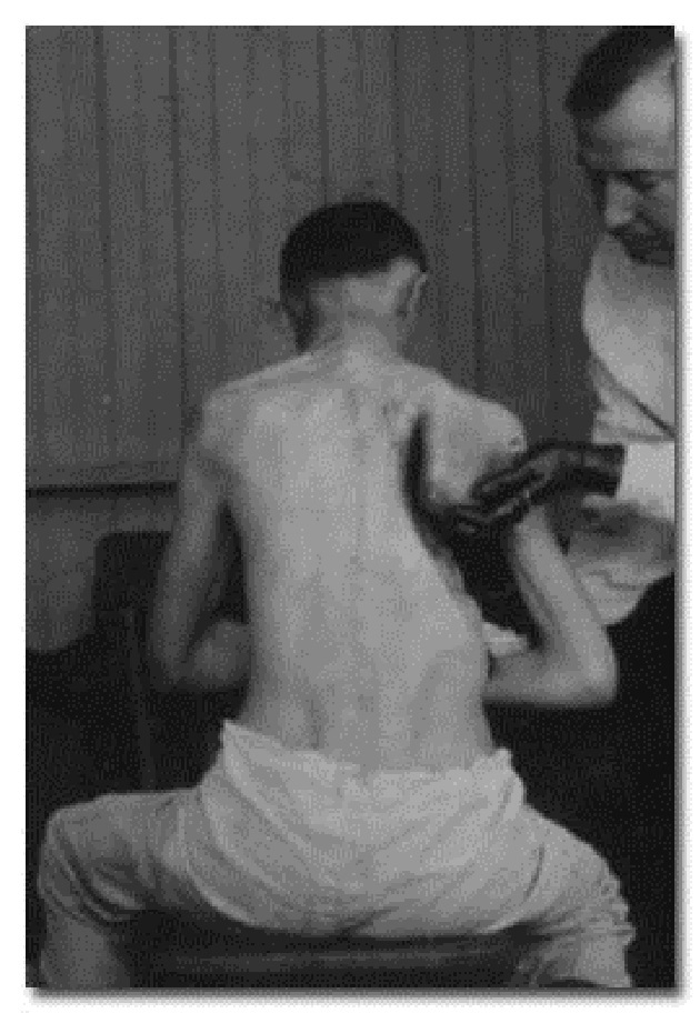 Ancient Medicine - Some barbaric compared to today's medical practices
