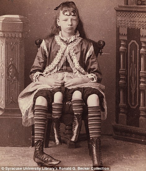 Carnival Sideshow Freaks - 19th Century