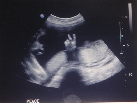 Funny Ultrasounds