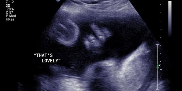 Funny Ultrasounds