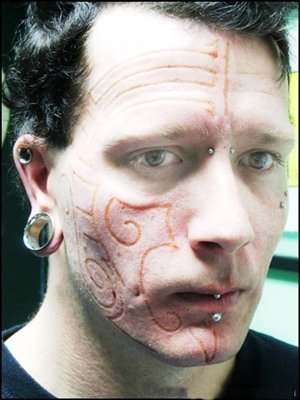 Scarification - the good and the bad