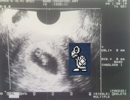 Funny Ultrasounds