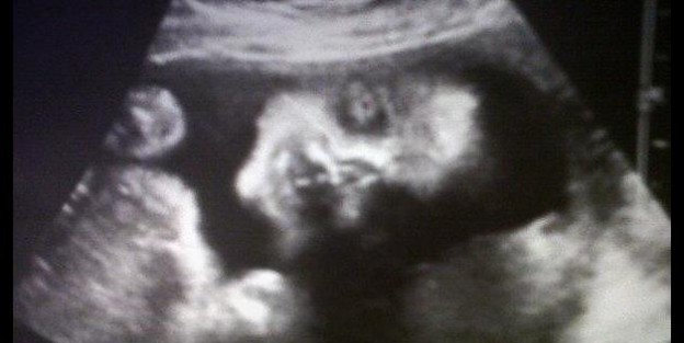 Funny Ultrasounds