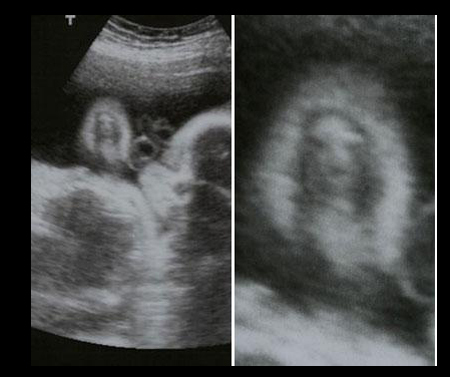 Funny Ultrasounds