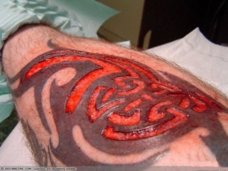 Scarification - the good and the bad