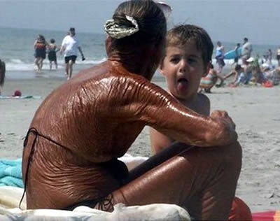 Worst Tan Disasters