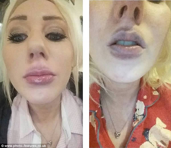 There's a fucking lip addiction