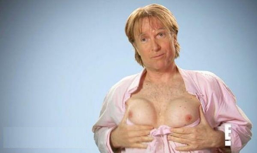 Men with female breasts