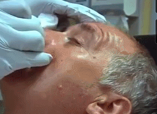 Pimples cysts and boils