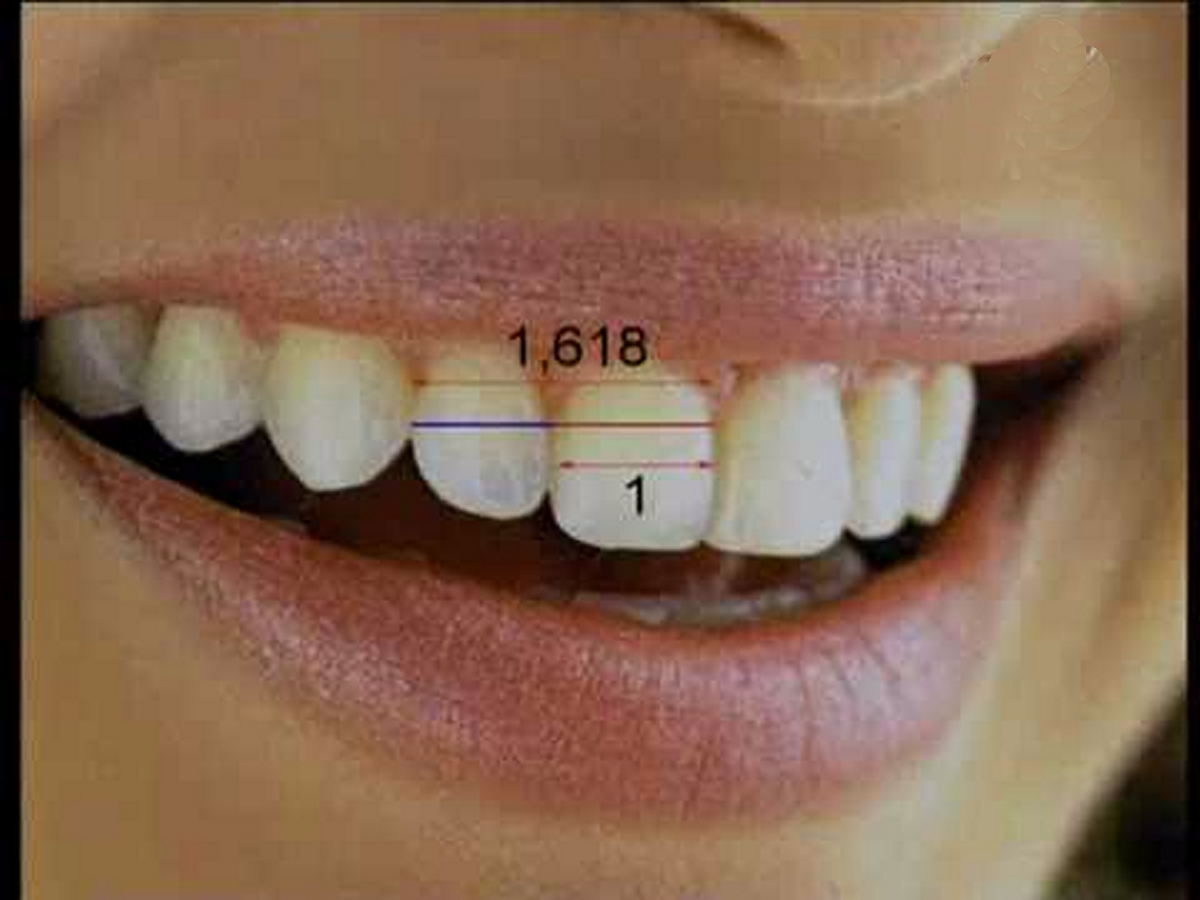 Worm's World Golden Ratio and Fibonacci Numbers