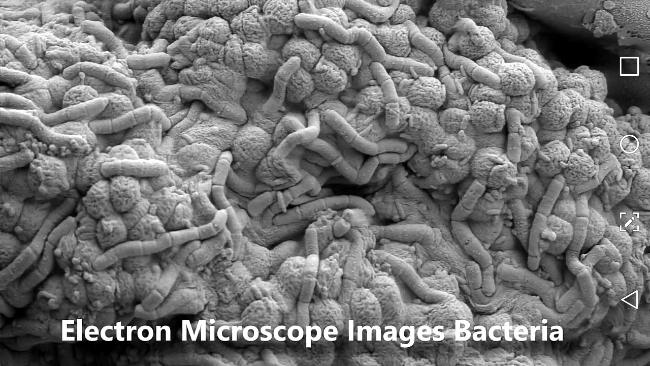 Scanning Electron Microscope Gallery 1