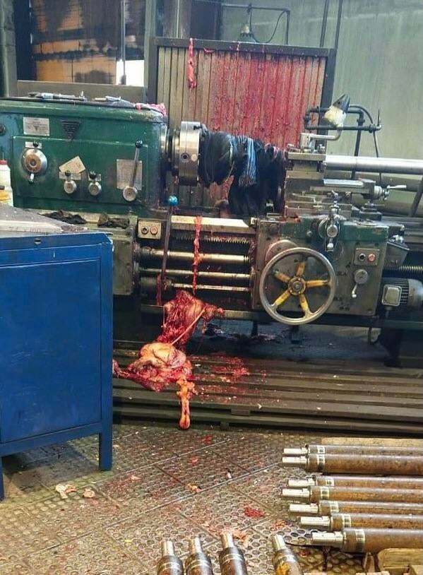 The Russian lathe accident aftermath pics(repost)