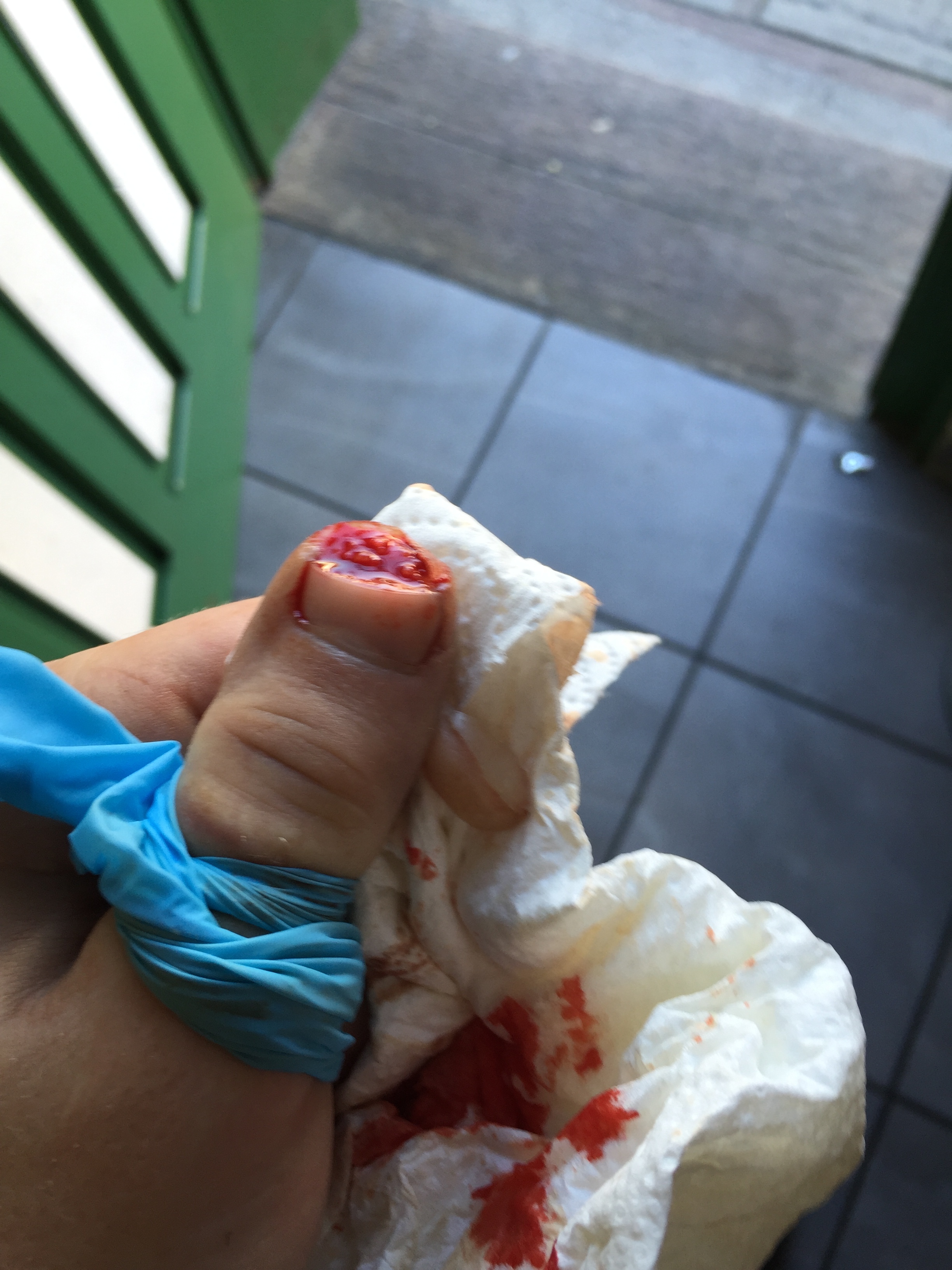 In 2016 I sliced onions and a bit of my thumb