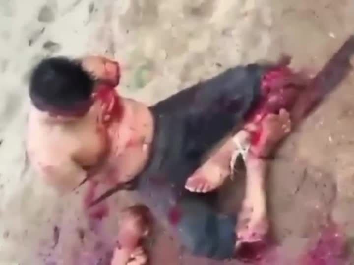 Down Syndrome Porn - Man with down's syndrome dismembered(repost)