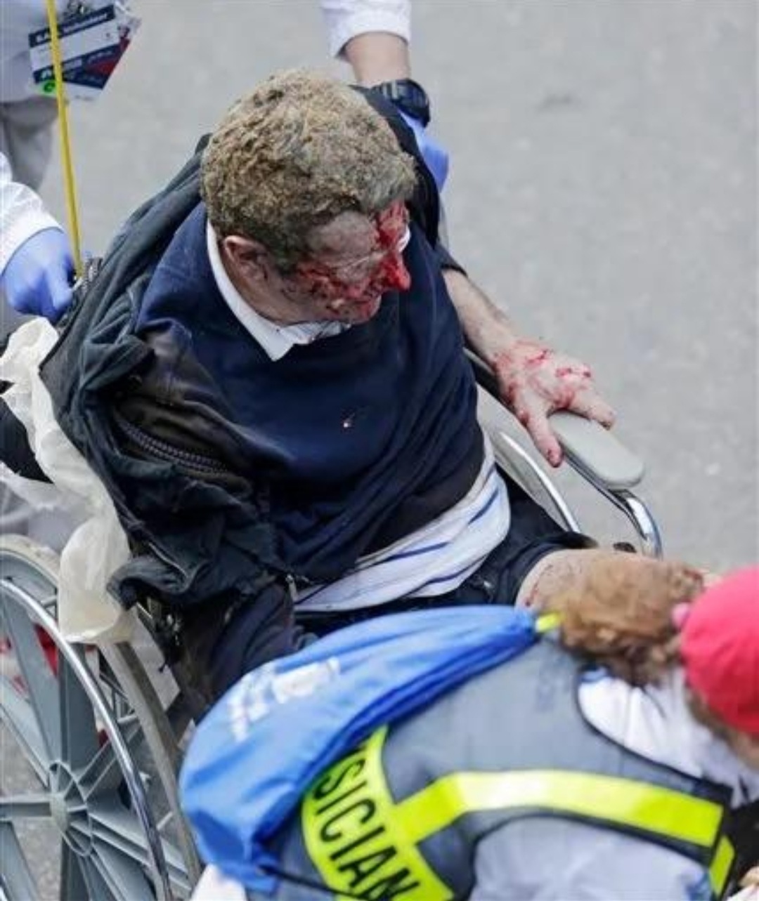 Boston Marathon bombing pic dump