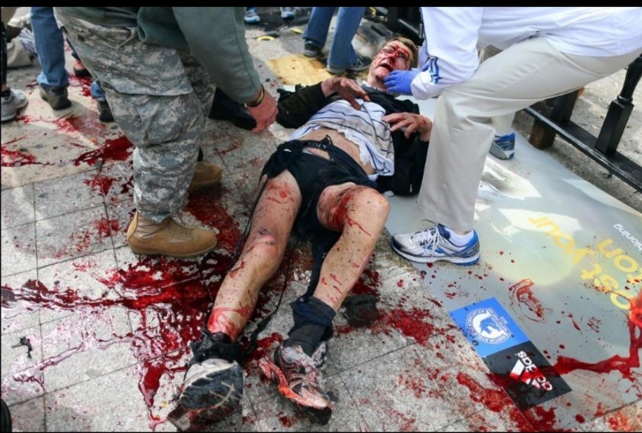 Boston Marathon bombing pic dump