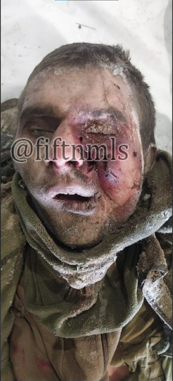 Ukrainian platoon killed by frostbite.