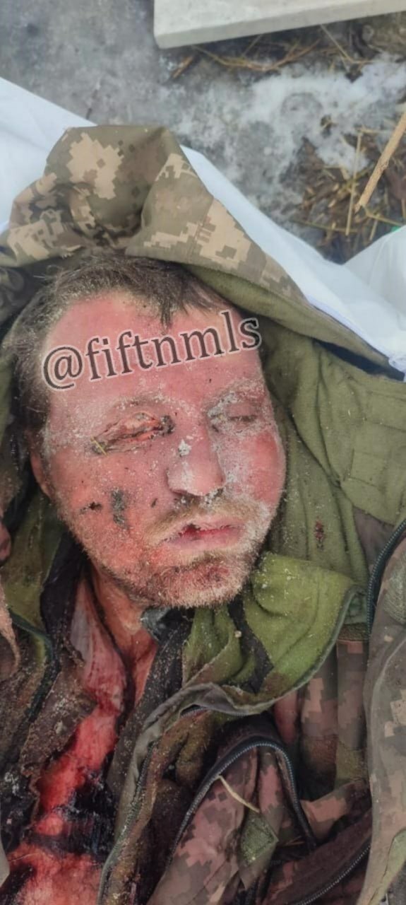 Ukrainian platoon killed by frostbite.