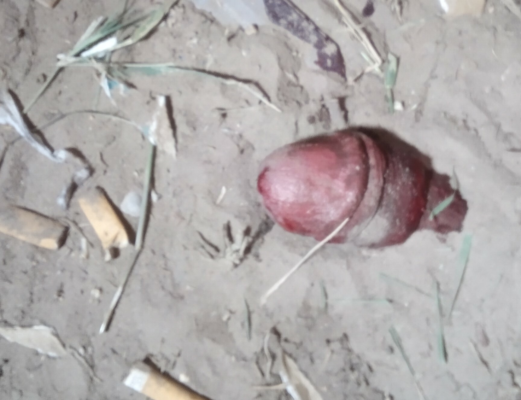 Severed penis found in the park