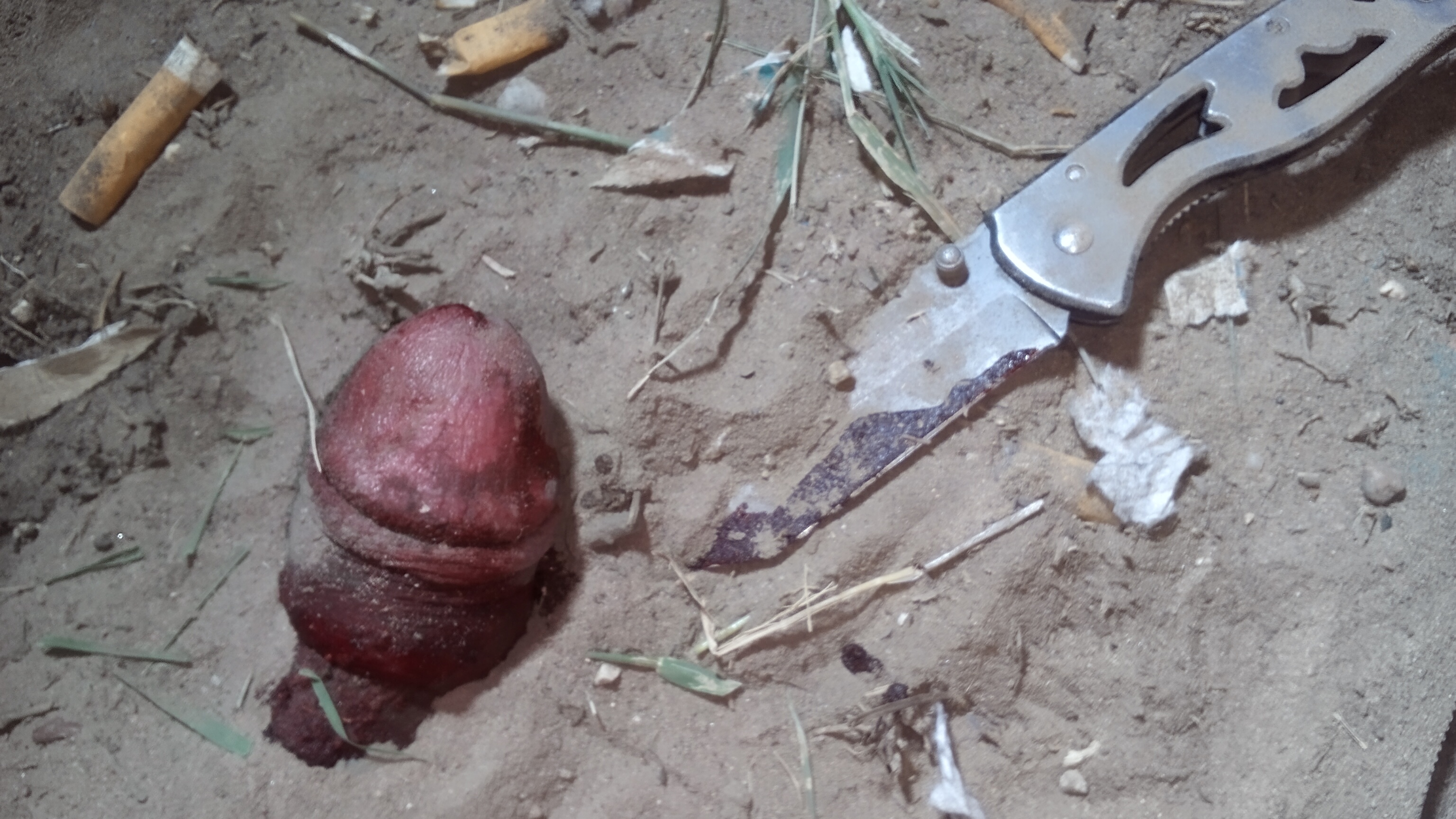 Severed penis found in the park