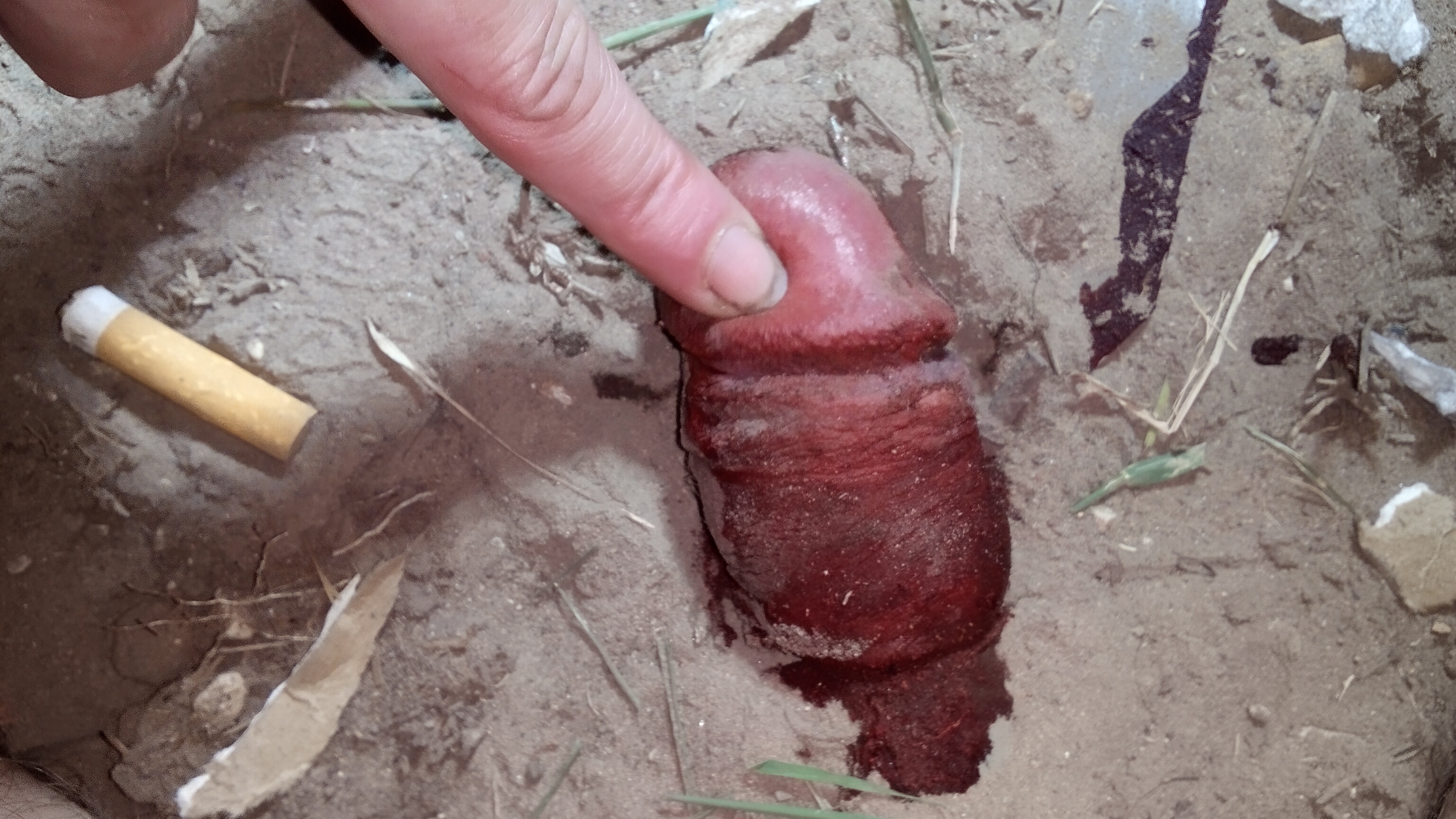 Severed penis found in the park