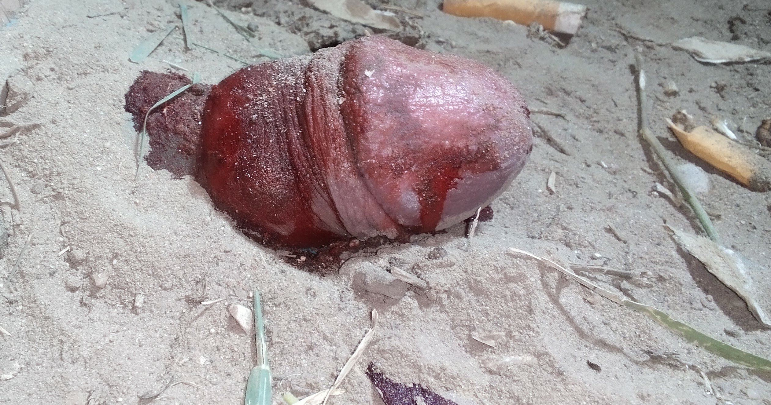 Severed penis found in the park