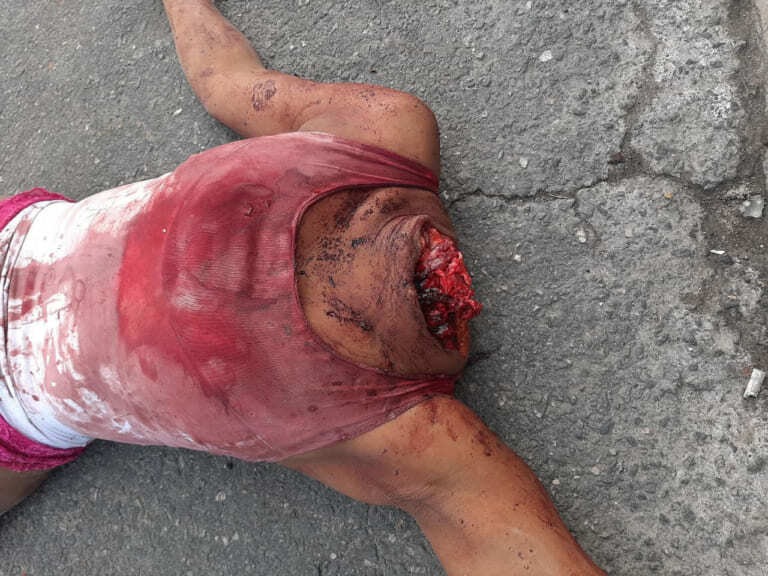 Beautiful Brazilian Beheaded (2020 aftermath pics)