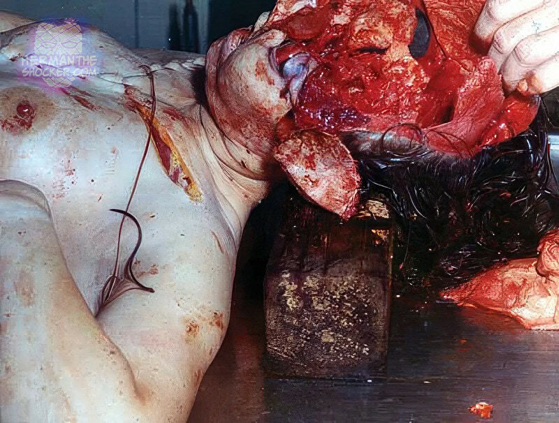 Rare Shotgun Suicide by Female