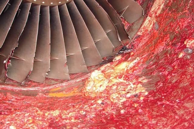 Aftermath of a accident of a mechanic(pictures)