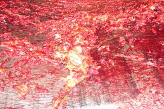 Aftermath of a accident of a mechanic(pictures)