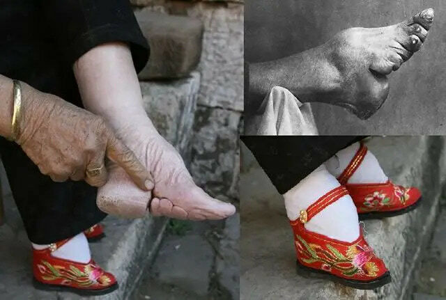 Sexy Foot Binding Gallery