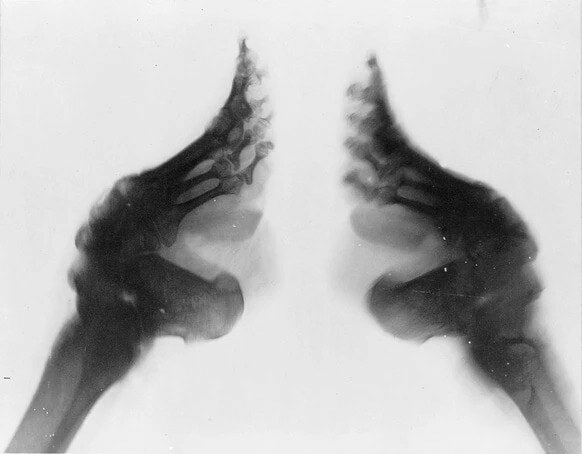 Sexy Foot Binding Gallery