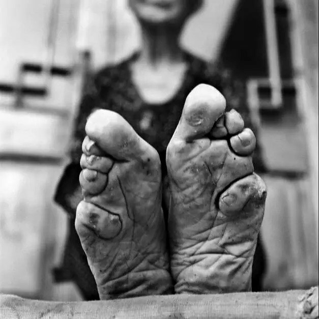 Sexy Foot Binding Gallery