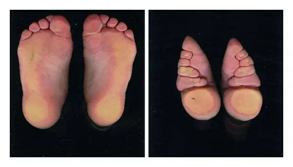Sexy Foot Binding Gallery