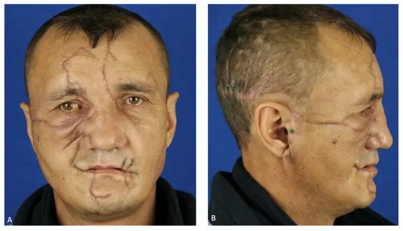 Bear Face Reconstruction Gallery