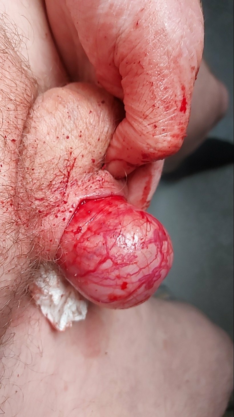 brumeato / scrotum cut open