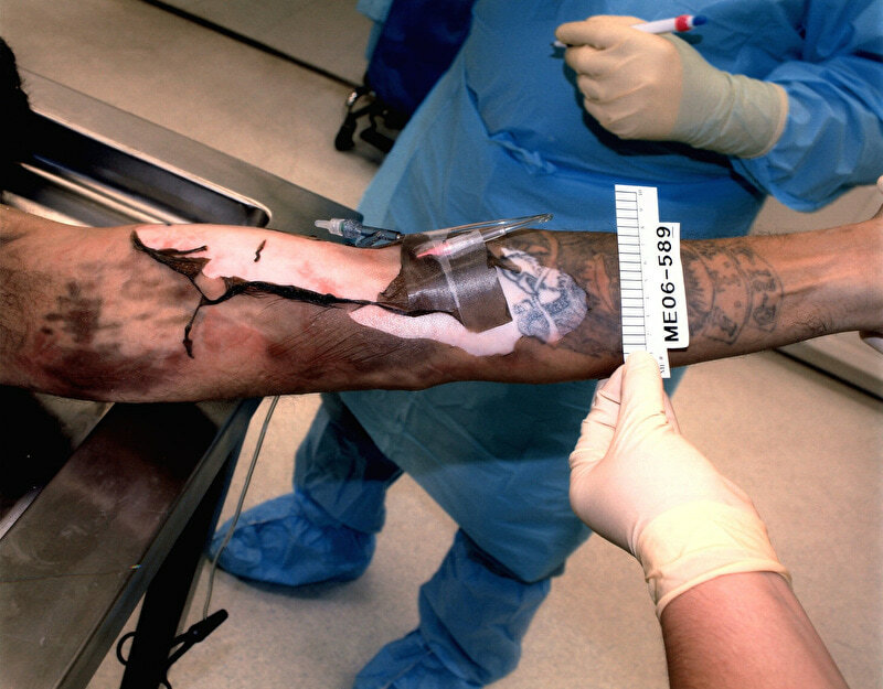 Lethal Injection Site Gallery