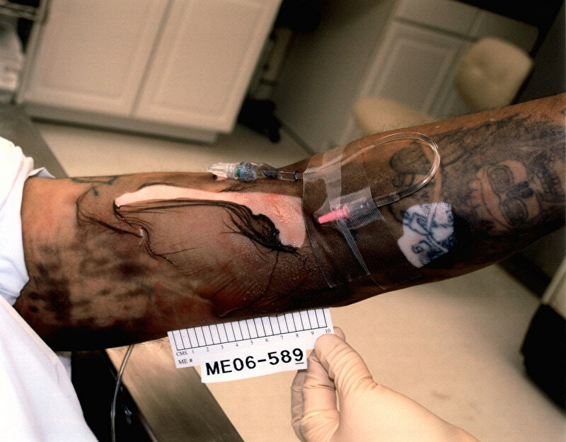 Lethal Injection Site Gallery