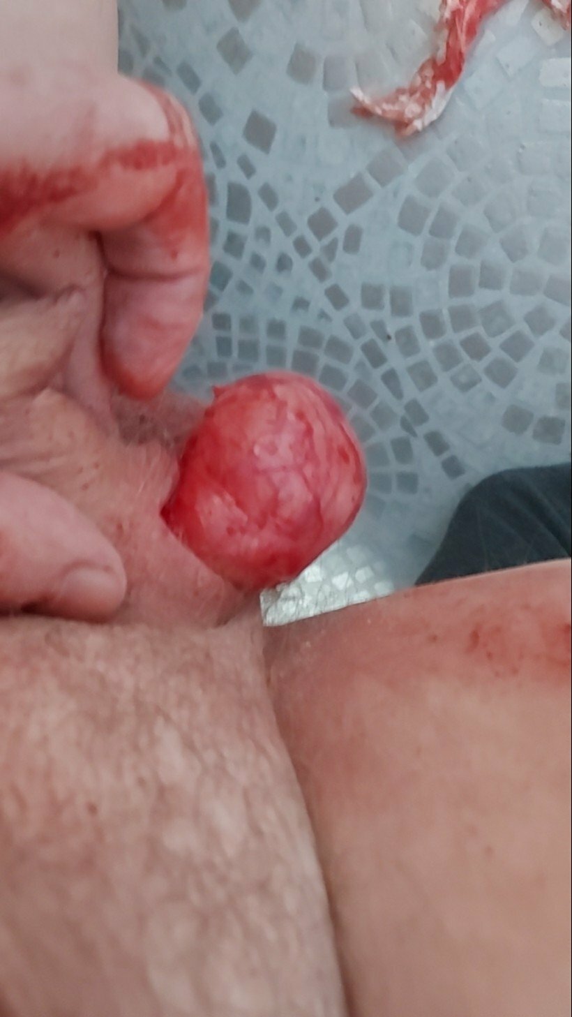 brumeato / scrotum cut open